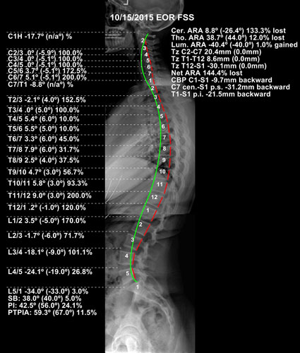 Chiropractic Urbandale IA After