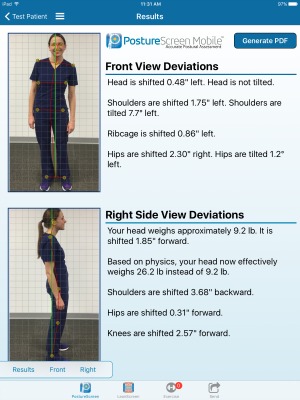 Chiropractic Urbandale IA Posture